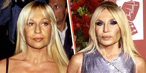 where does donatella versace live now|donatella before and after.